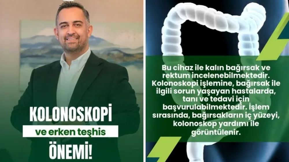 Doç.Dr. Alp Yıldız: Kolonoskopi erken teşhisde oldukça önemli